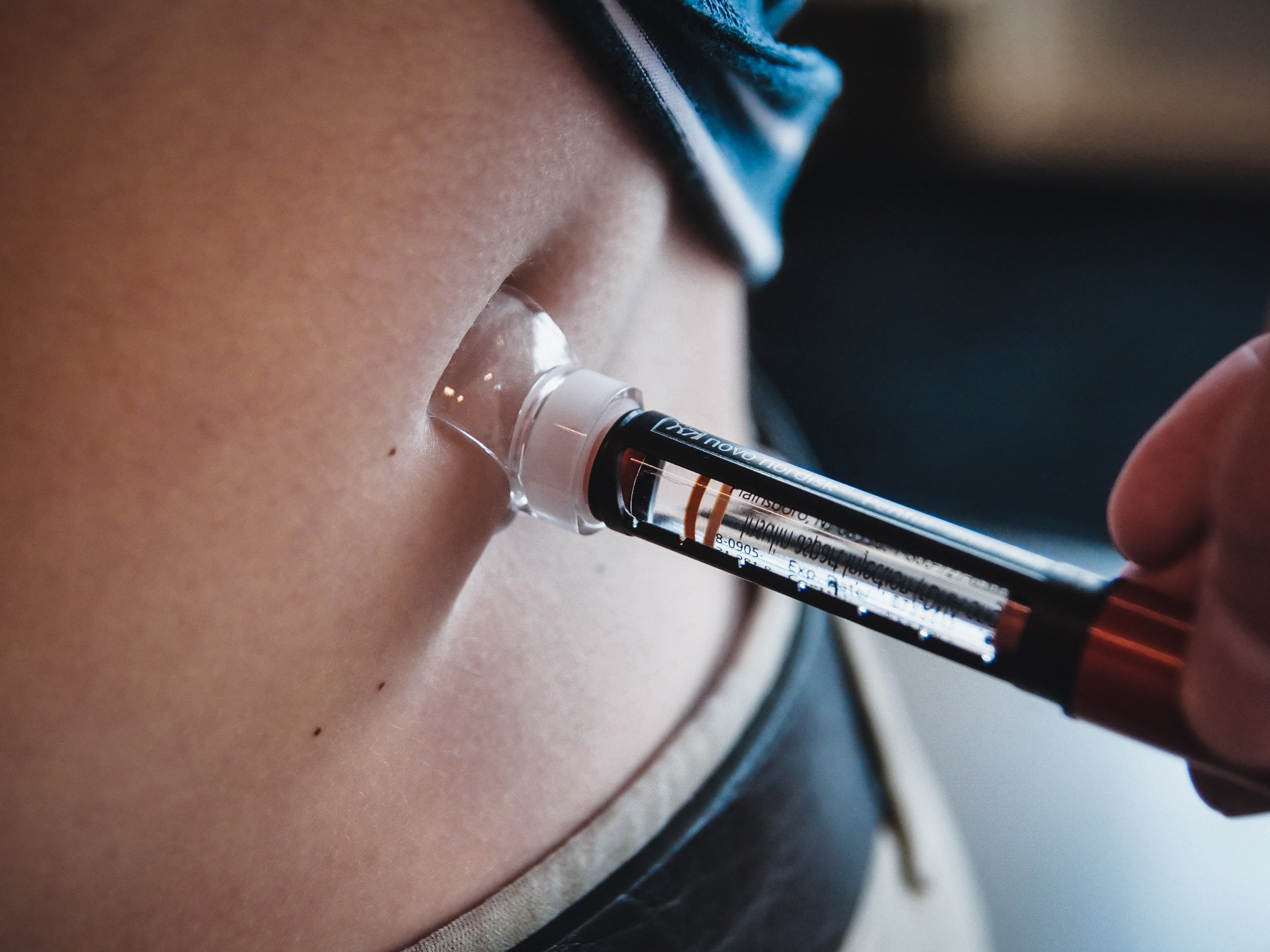 Steady Shot large size attached to 6mm insulin pen needle giving an injection in the abdomen. Diabetic-friendly tool for accurate and comfortable injection site rotation, reducing lipohypertrophy and improving diabetes management.