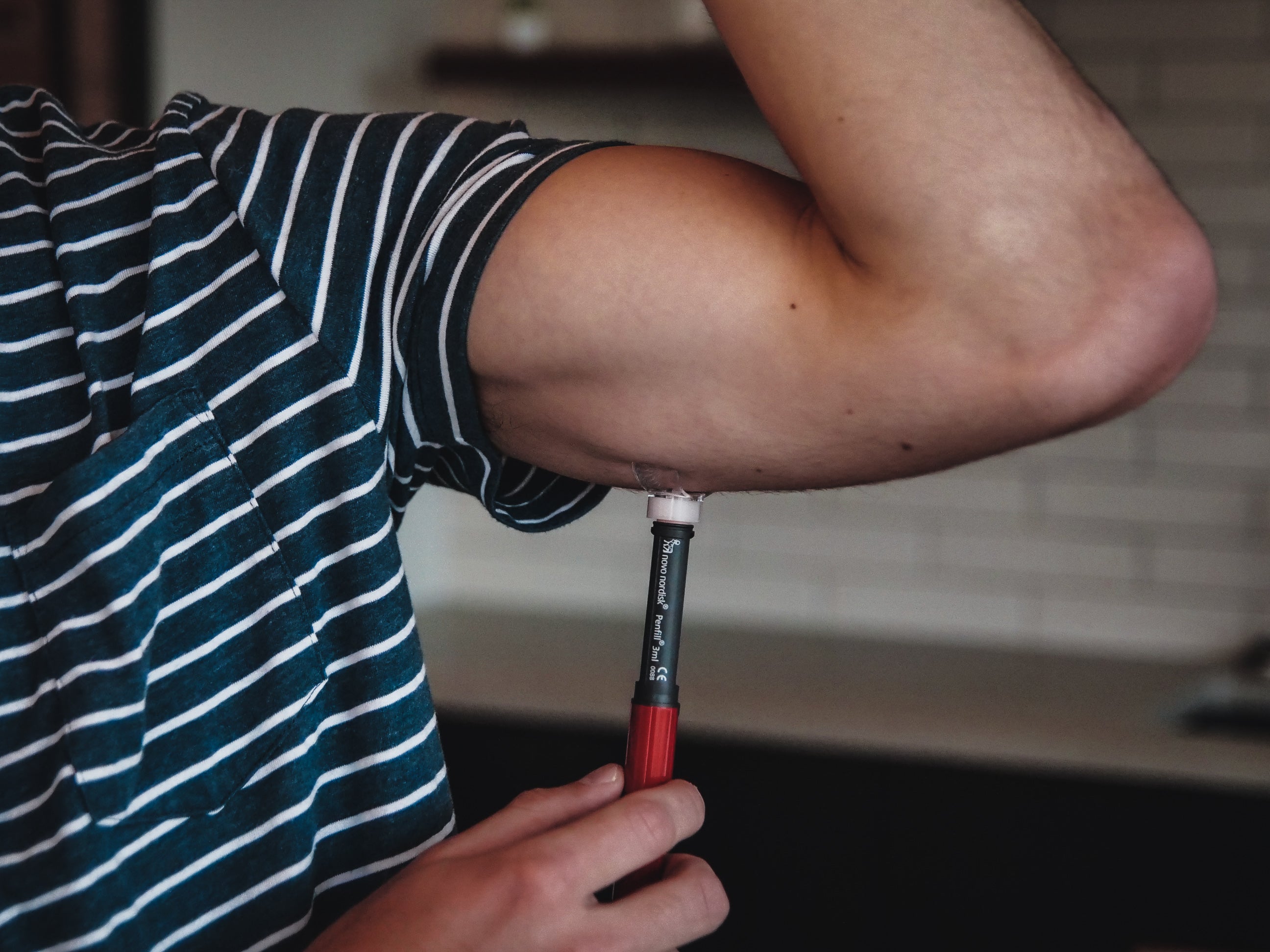 Steady Shot small size attached to 4mm insulin pen needle giving an injection in the arm. Designed for diabetics to ensure accurate injection site rotation, improving comfort and diabetes management.
