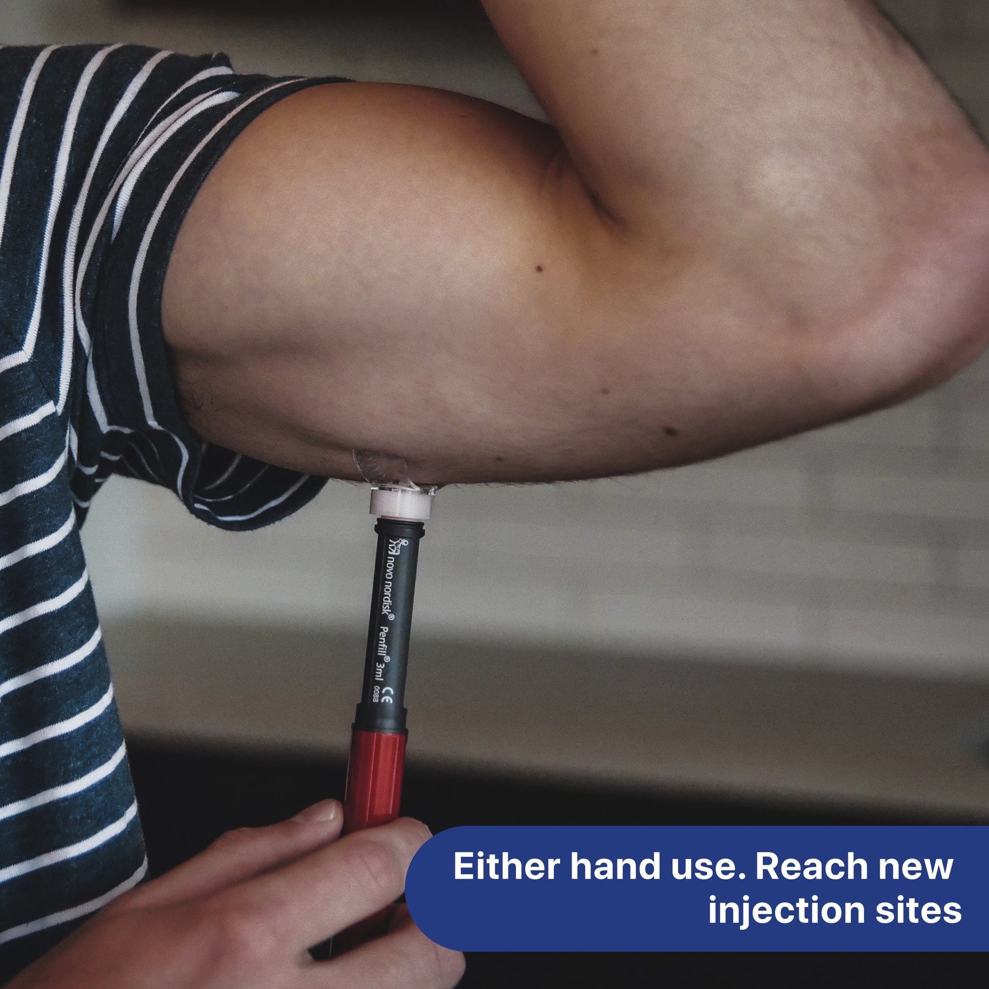 Steady Shot being used for an arm injection with either hand, helping diabetics reach new injection sites. A reusable tool designed to improve injection site rotation and ensure comfortable, precise insulin delivery.